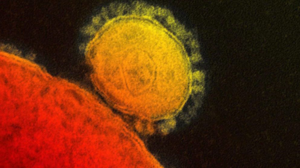 Second Us Mers Case Found In Florida Abc News Second Us Mers Case Found In Florida Abc News
