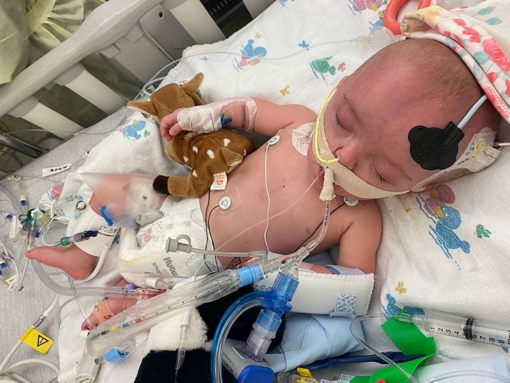 PHOTO: Ariella Rain, 7 months, on life support as she battles RSV and bronchitis at OHSU Doernbecher Children's Hospital in Portland, Ore., Nov. 7, 2022.