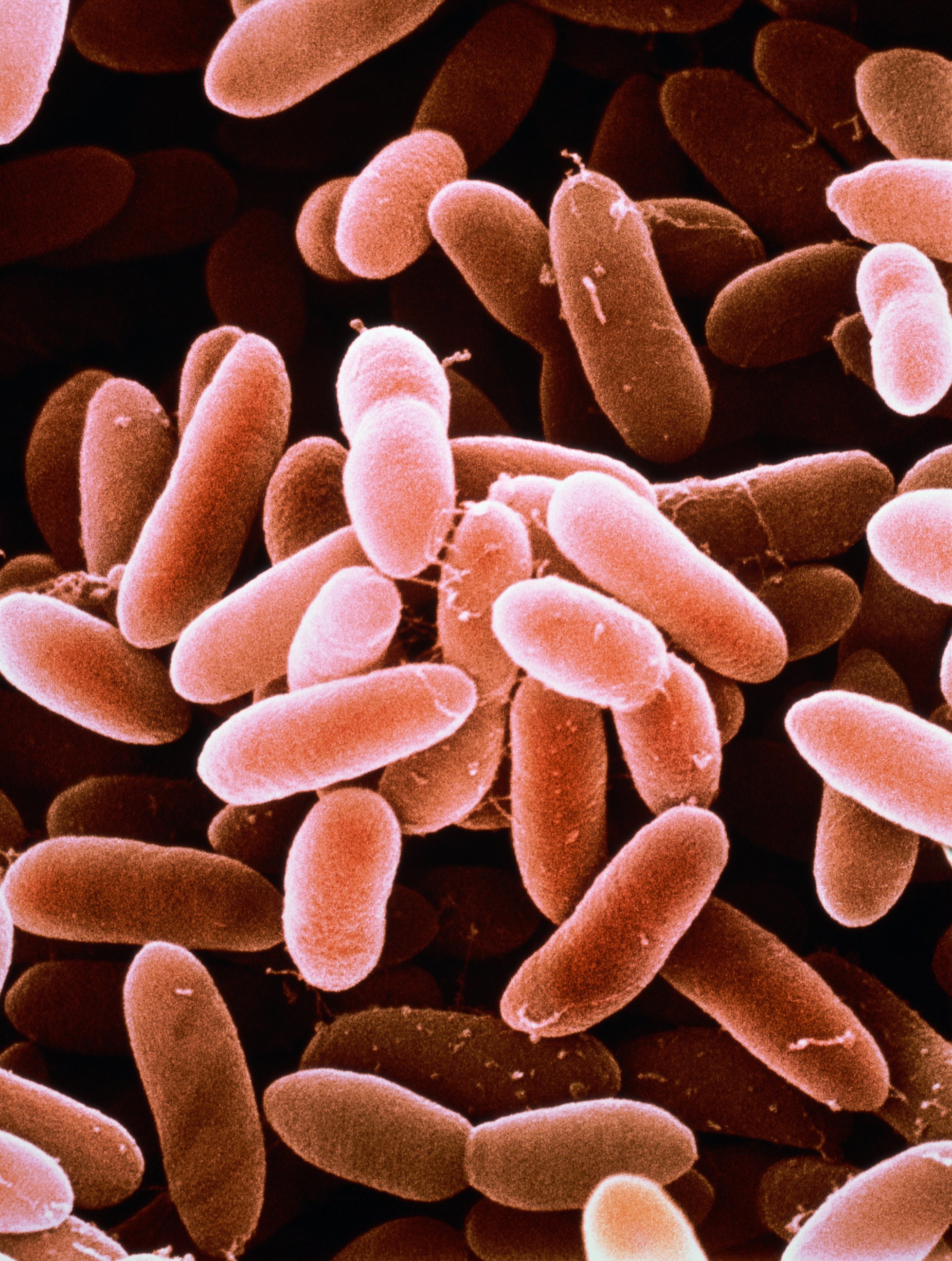 PHOTO: Listeria monocytogenes bacteria