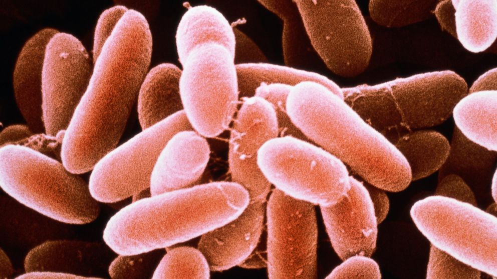PHOTO: Listeria monocytogenes bacteria