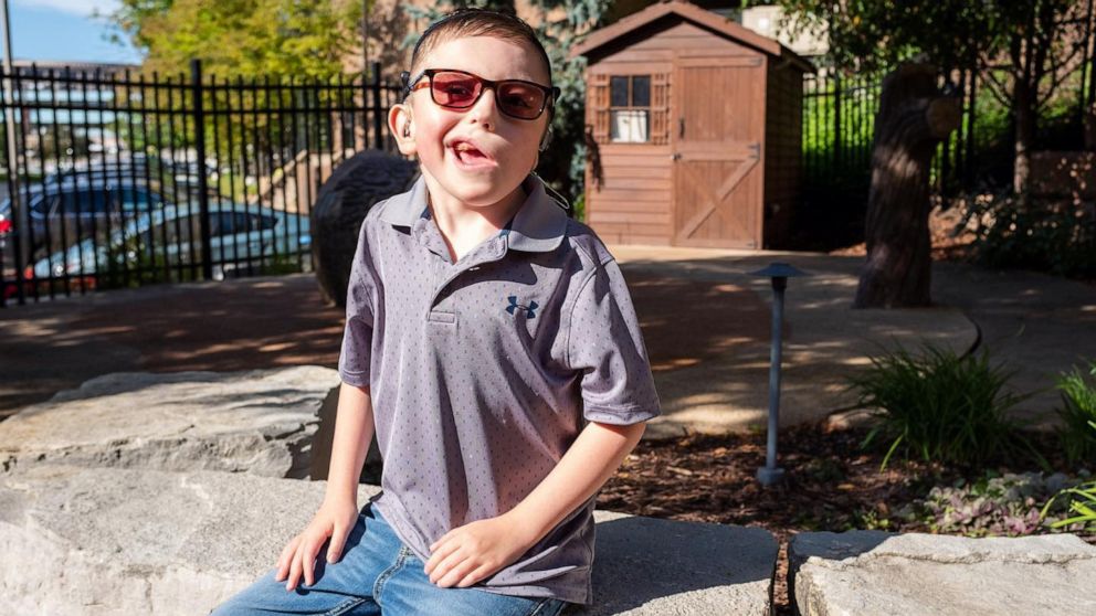 VIDEO: Boy with 1 ear gets life-changing glasses