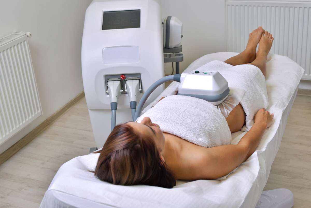 PHOTO: A woman undergoes cryolipolysis in this undated stock photo.
