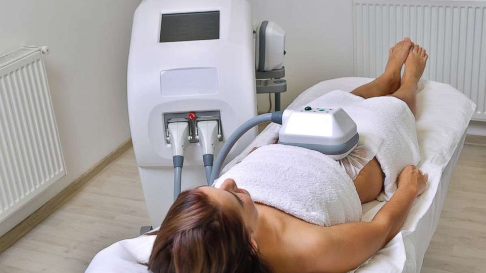 A woman undergoes cryolipolysis in this undated stock photo.
