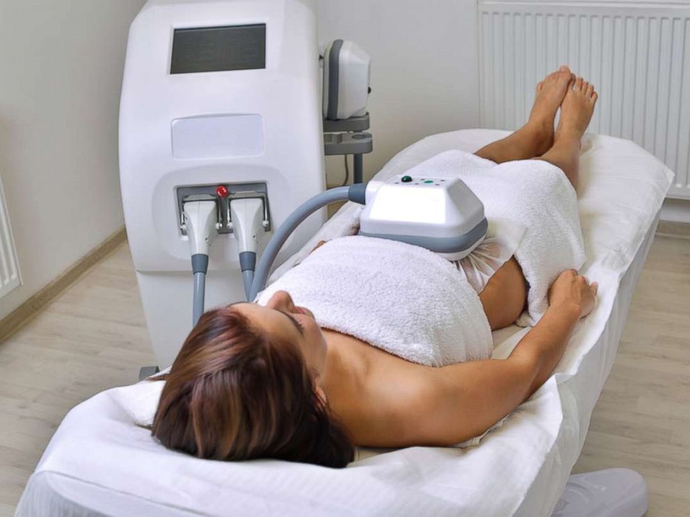 PHOTO: A woman undergoes cryolipolysis in this undated stock photo.