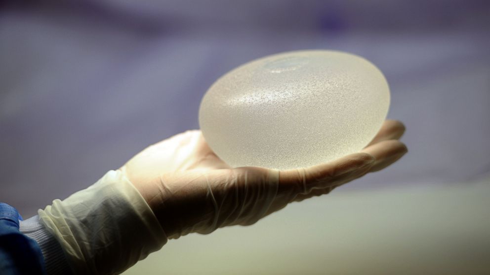 A technician presents a silicone breast implant in this undated file photo.
