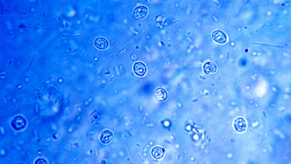 Cryptosporidium is a microscopic parasite that can live in the intestines of humans and animals. 