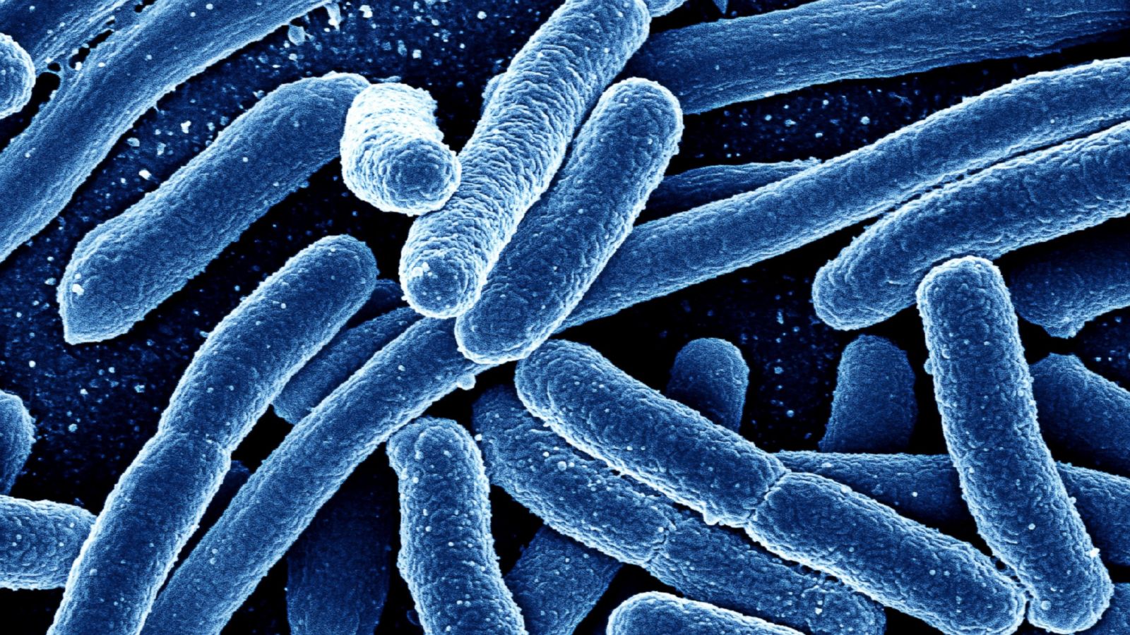 e coli bacteria
