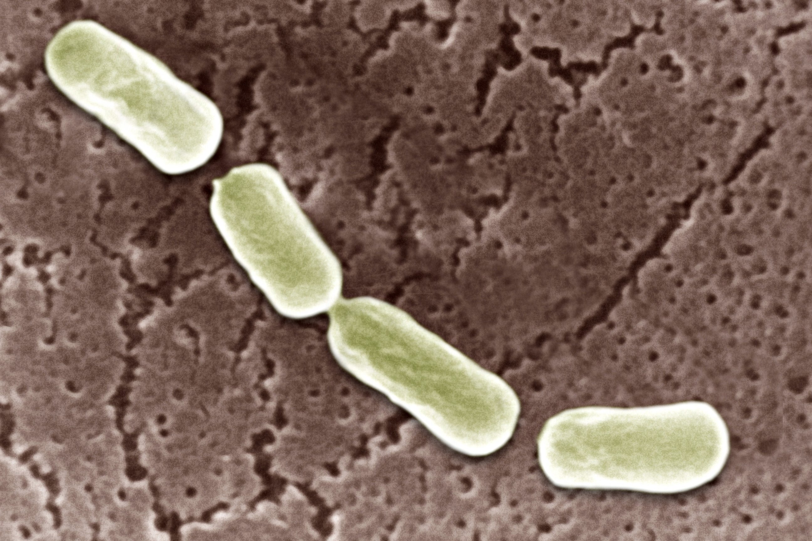 PHOTO: Clostridium Botulinum is seen through an electron microscope.
