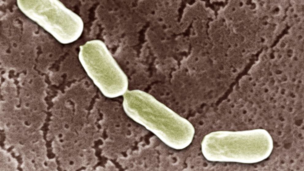 PHOTO: Clostridium Botulinum is seen through an electron microscope.