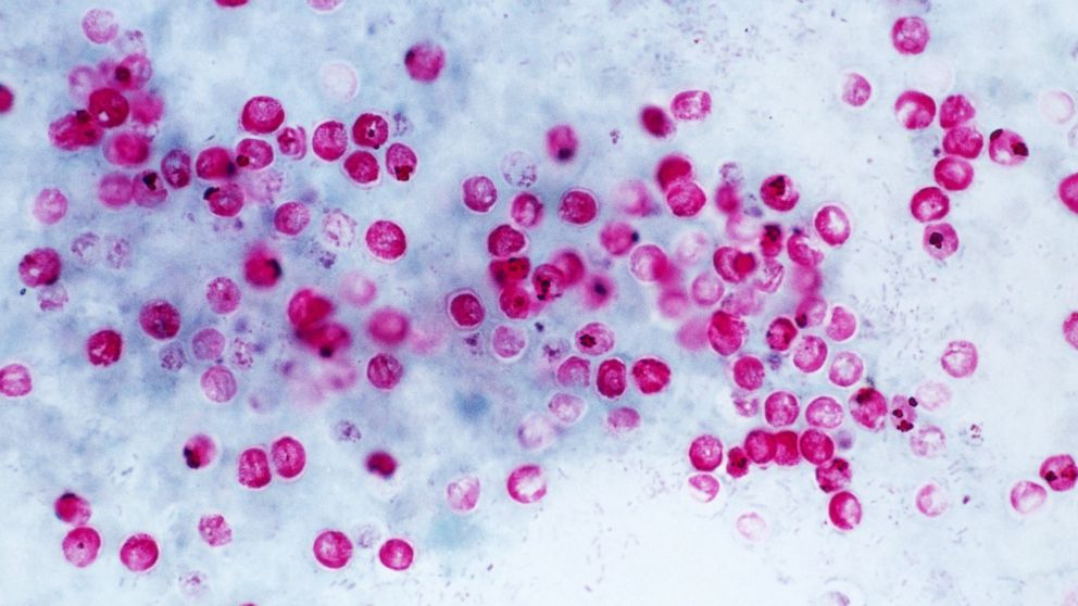 PHOTO: Cryptosporidium parvum protozoa