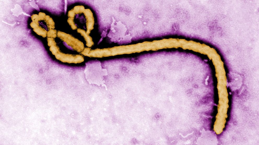 In this handout from the Center for Disease Control, a colorized transmission electron micrograph of a Ebola virus virion is seen. 