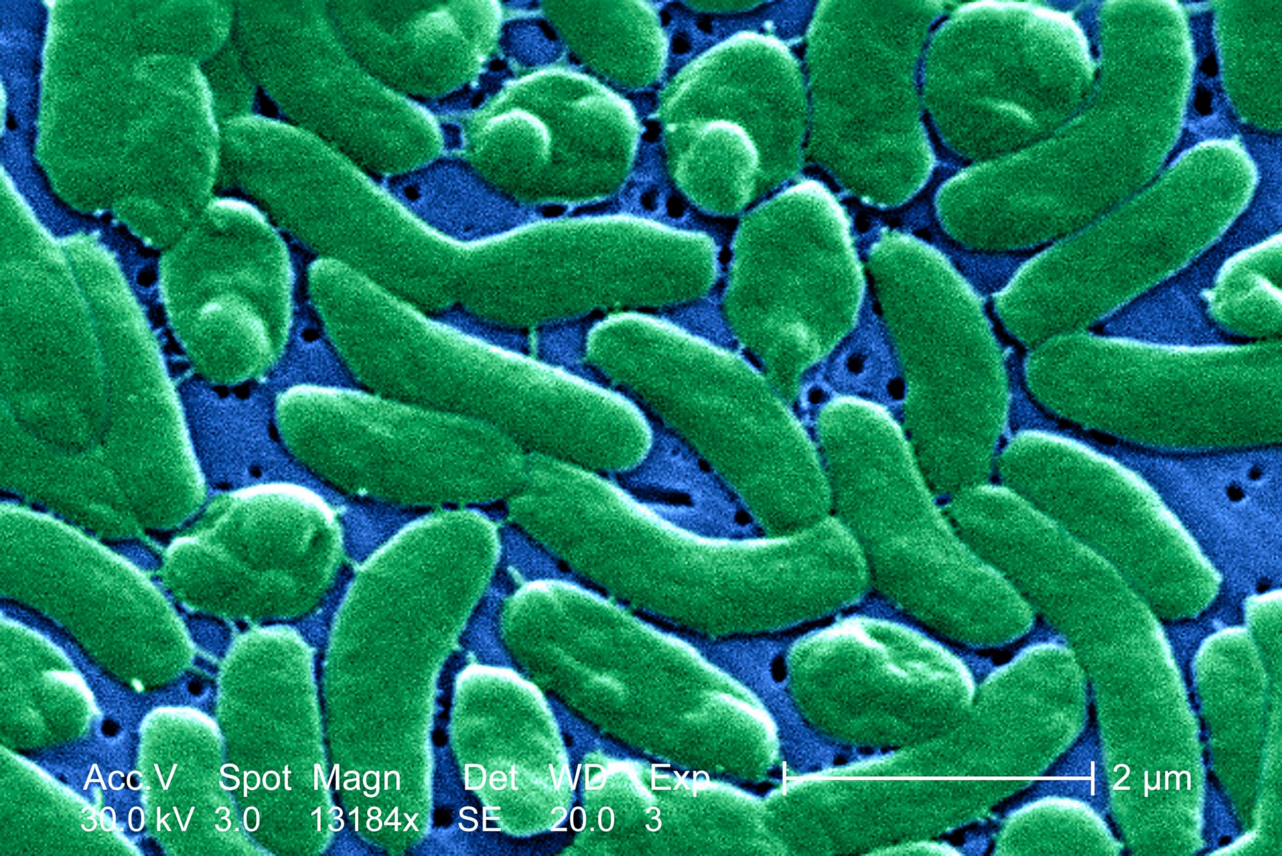 PHOTO: A grouping of Vibrio vulnificus bacteria is pictured in this micrograph.