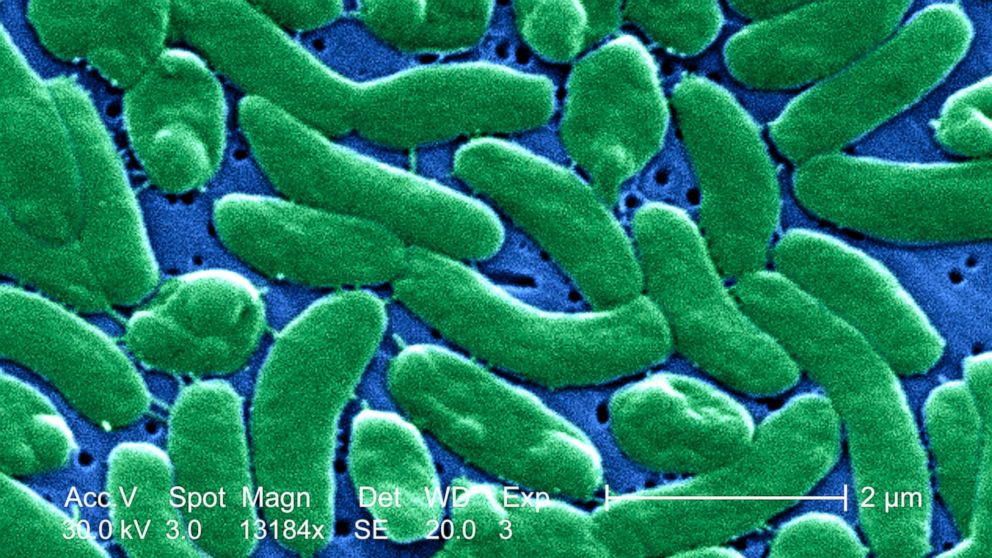A grouping of Vibrio vulnificus bacteria is pictured in this micrograph.