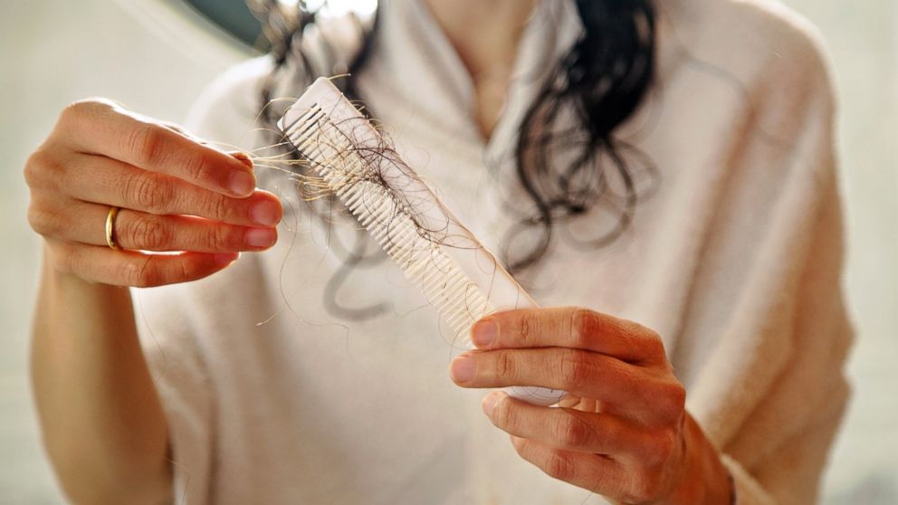 A woman holds a comb full of fallen hair in this stock image.