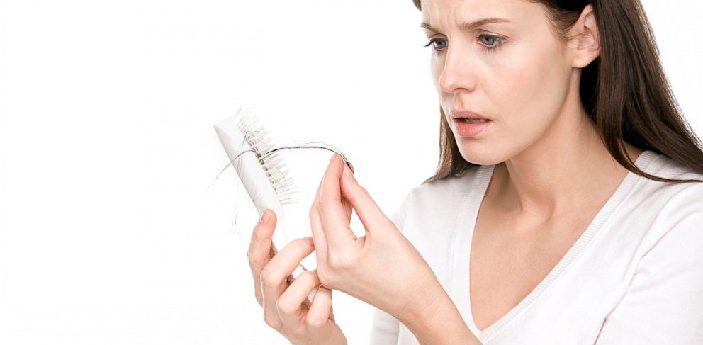 why is hair loss common