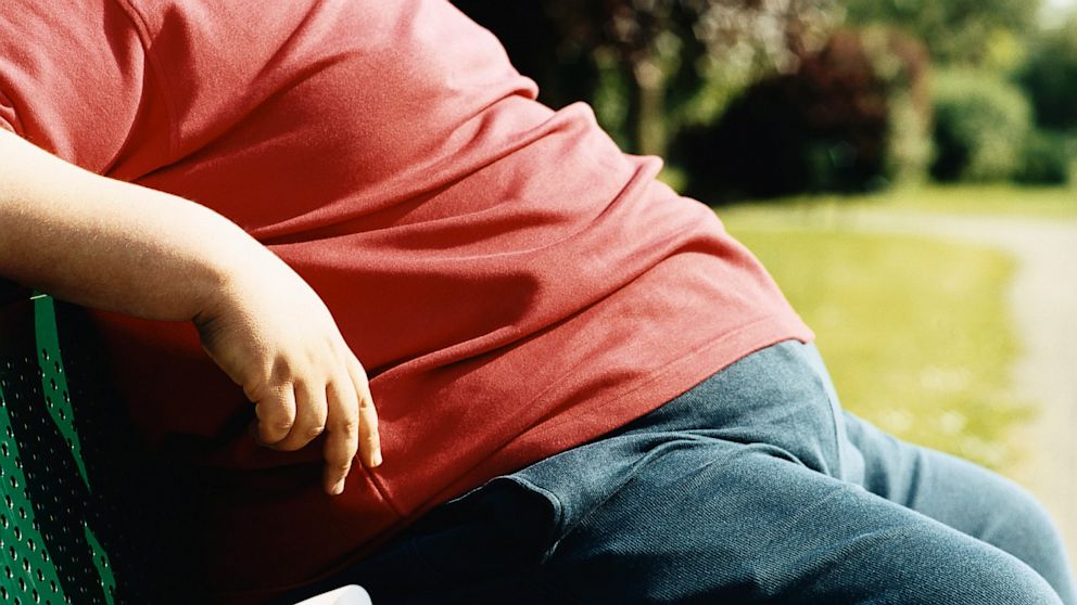 Some researchers say there are multiple contributors fueling the obesity epidemic.