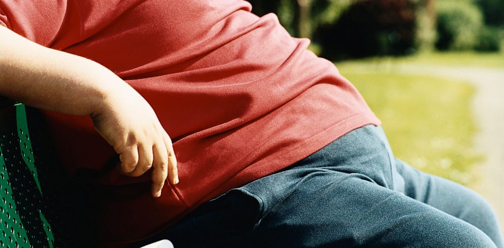 Obesity Has Multiple Causes, Few Cures - ABC News