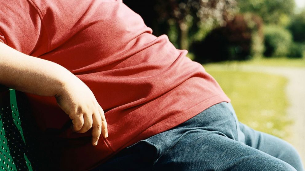Obesity Epidemic Grows In Adults Perhaps Levels Off In Youth Abc News