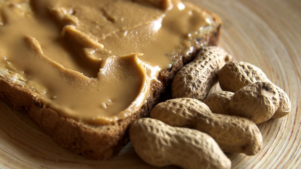 A new study finds that an early exposure to peanuts in children may prevent peanut allergies.
