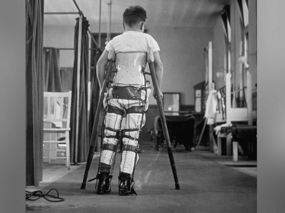PHOTO: A child suffering from Infantile Paralysis learns to walk with the aid of a special support, at Queen Mary's Hospital, London, 1947.