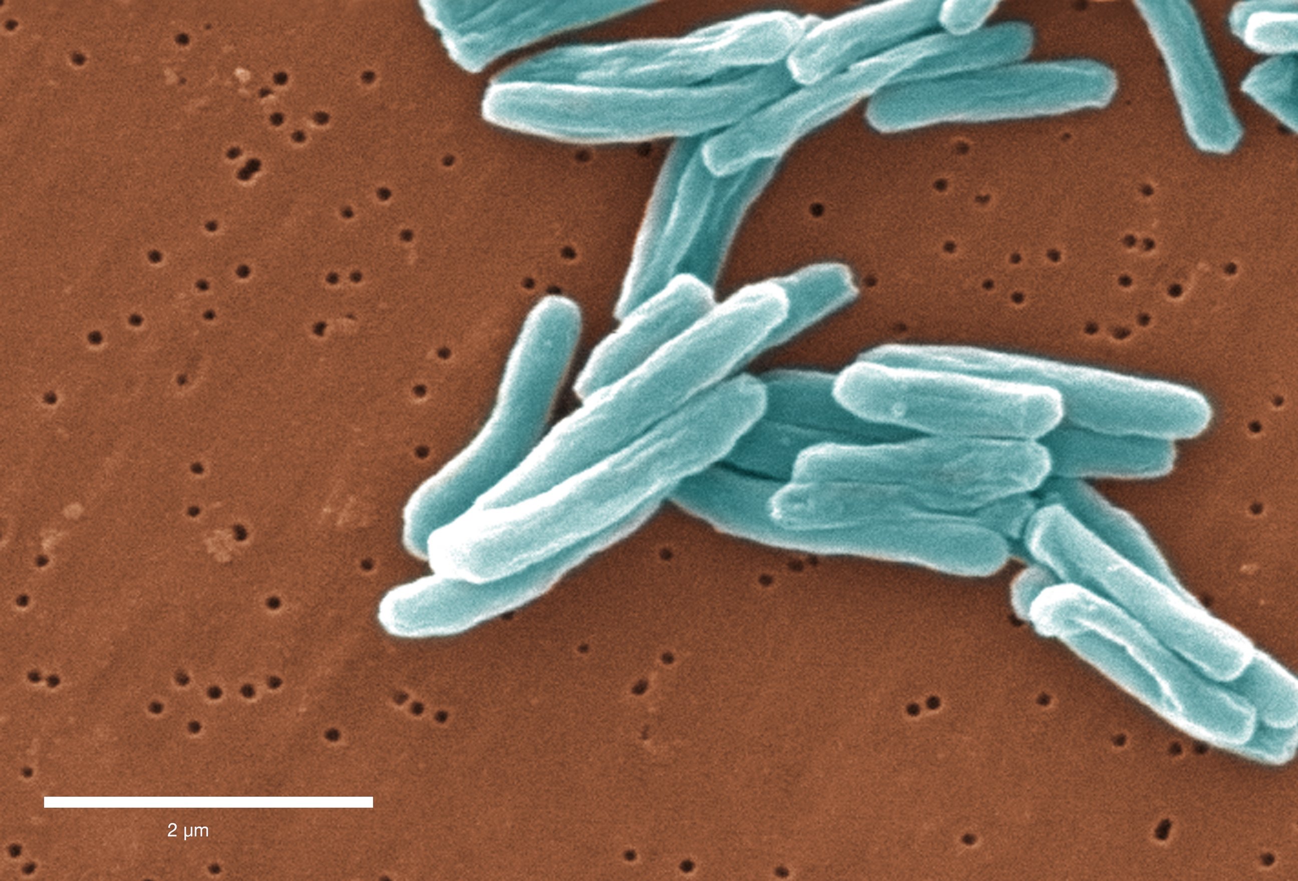 Тест на микобактерию. Палочка Коха (Mycobacterium tuberculosis). Микобактерии туберкулеза микроскопия. Палочка Коха микробиология. Бактерия Коха под микроскопом.