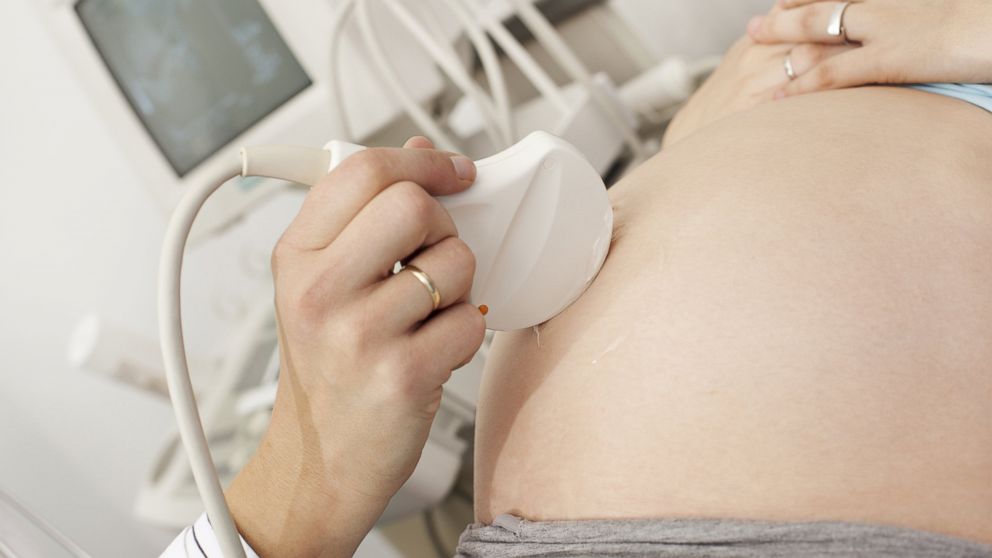 PHOTO: Having an ultrasound beforehand does not significantly deter women seeking abortions