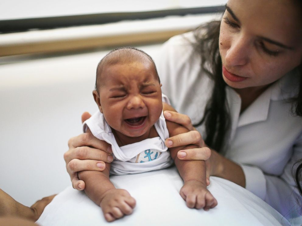 PHOTO: Dr. Valeria Barros treats a 6-week old baby born with microcephaly at the Lessa de Andrade polyclinic during a physical therapy session, Jan. 29, 2016 in Recife, Brazil.