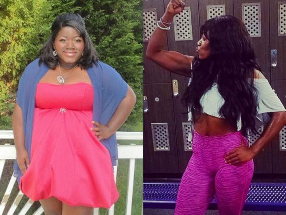 PHOTO: Diana Anguh, 24, of Silver Spring, Maryland, lost 140 pounds and now works as a chef.