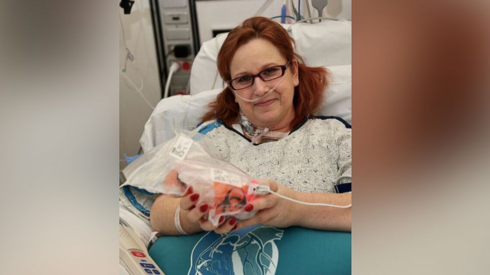 Lisa Salberg holds her own heart after having heart transplant. 