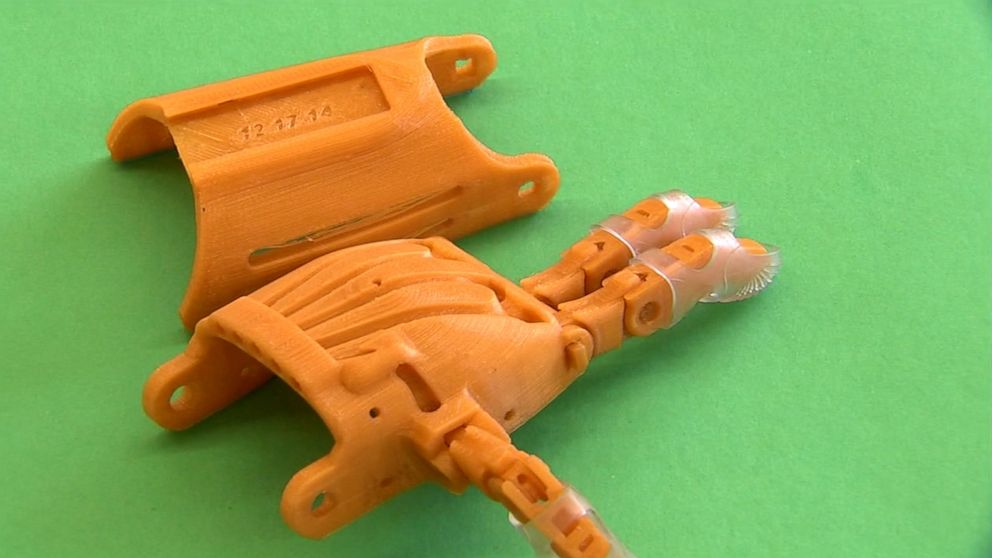 PHOTO: Eighth-graders at Howard B. Mattlin Middle School in Plainview, New York, are using a 3-D printer to create prosthetic hands for other children in need of them. 