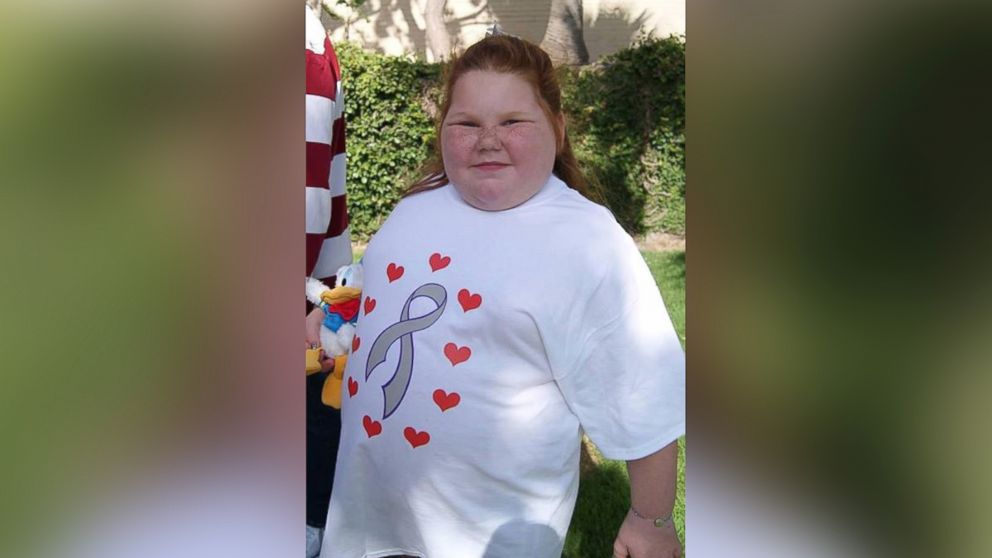Alexis Shapiro has gained over 100 pounds after having a benign brain tumor removed. 