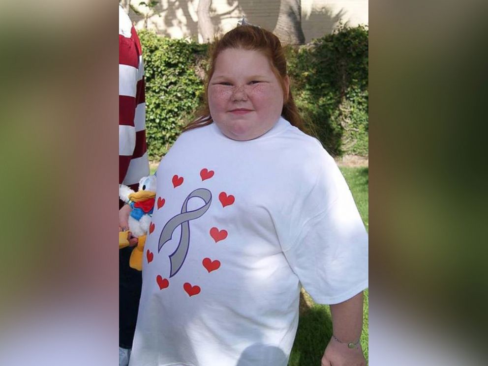 PHOTO: Alexis Shapiro has gained over 100 pounds after having a benign brain tumor removed. 