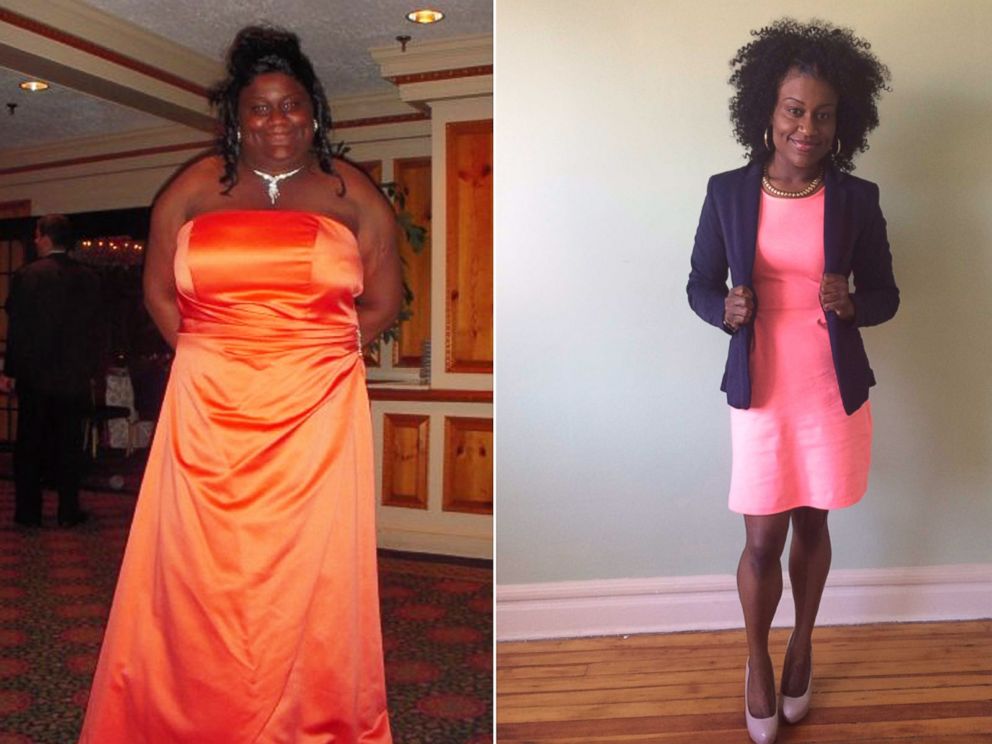 Judith Anthony is shown before and after her dramatic weight loss.PHOTO: 