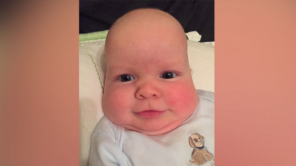 baby-with-big-cheeks-captions-profile