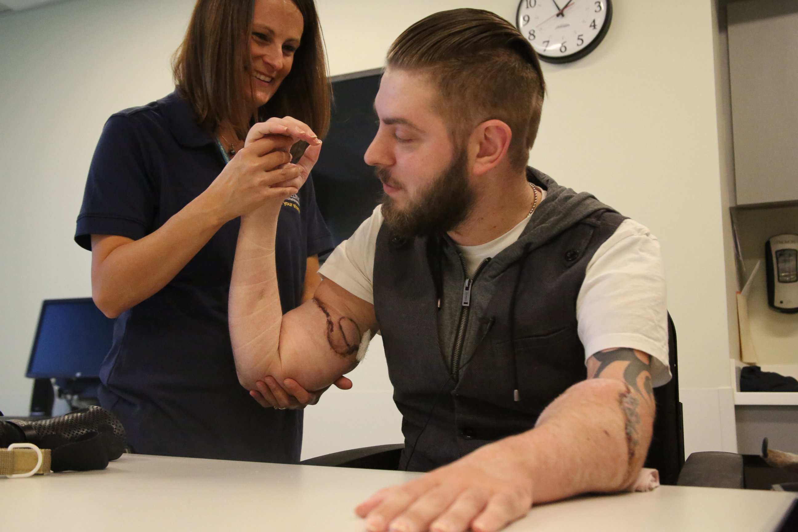 PHOTO: Marine veteran John Peck received a double hand transplant recently after losing his arms in combat. 