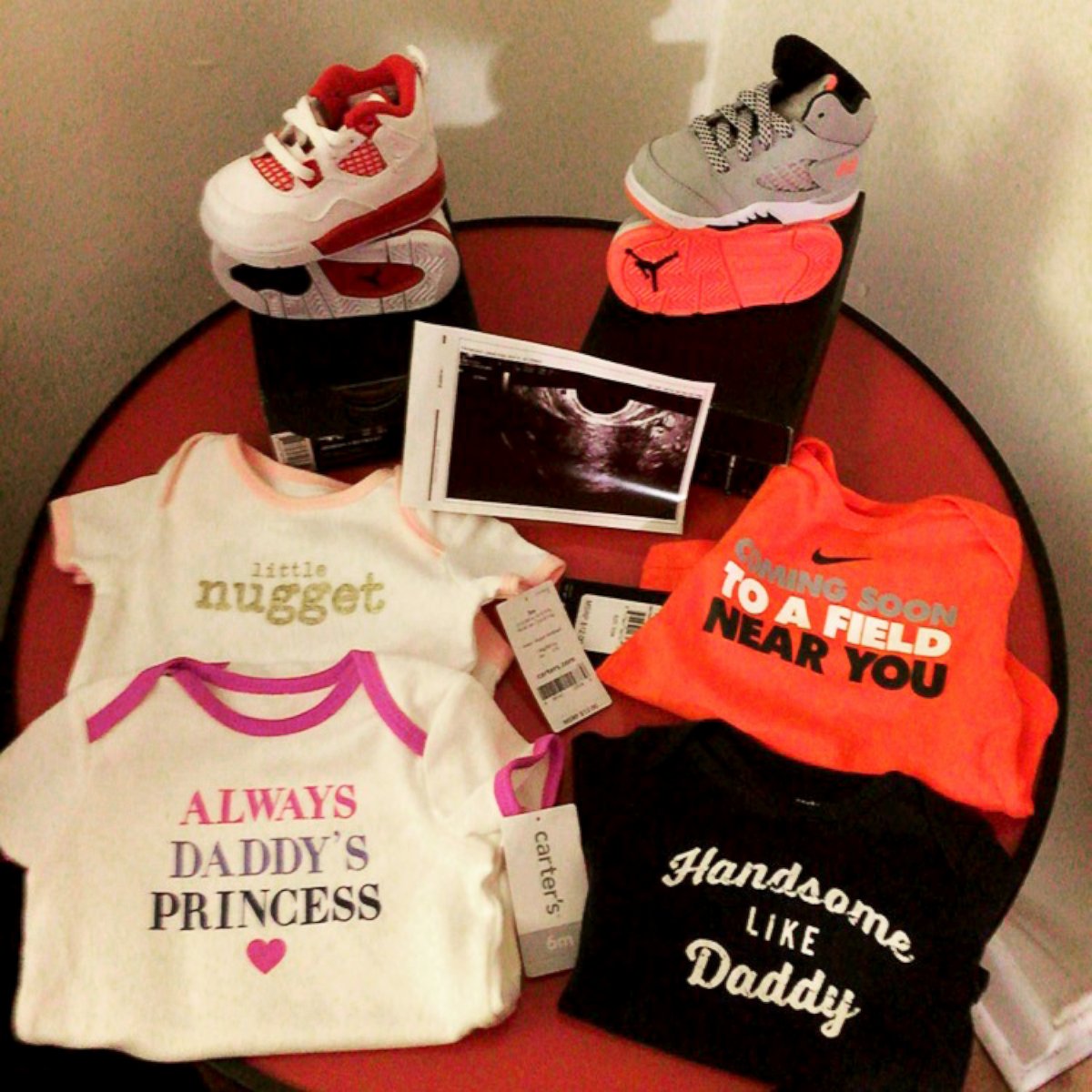 PHOTO: David and Ivonne Trinidad's sonogram and baby clothes. 