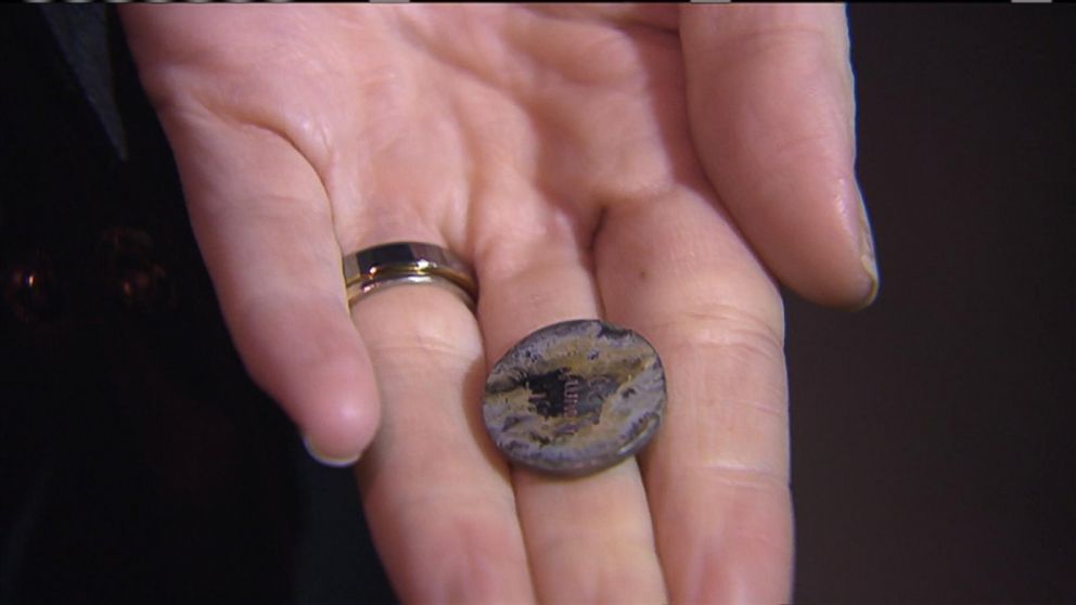 PHOTO:Katie Smith, 2, had this circular lithium battery lodged in her esophagus.  