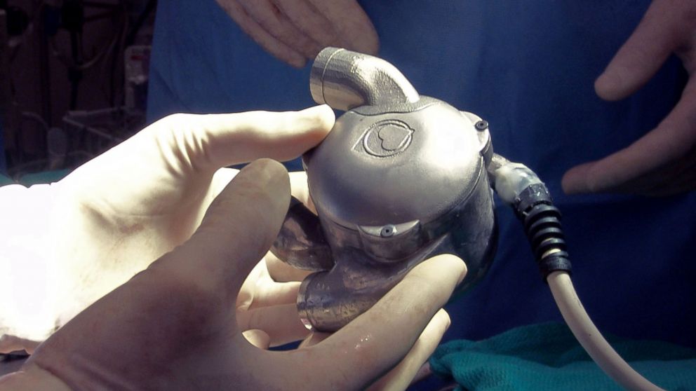 PHOTO: Scientists at the Texas Heart Institute are working to create a permanent artificial heart