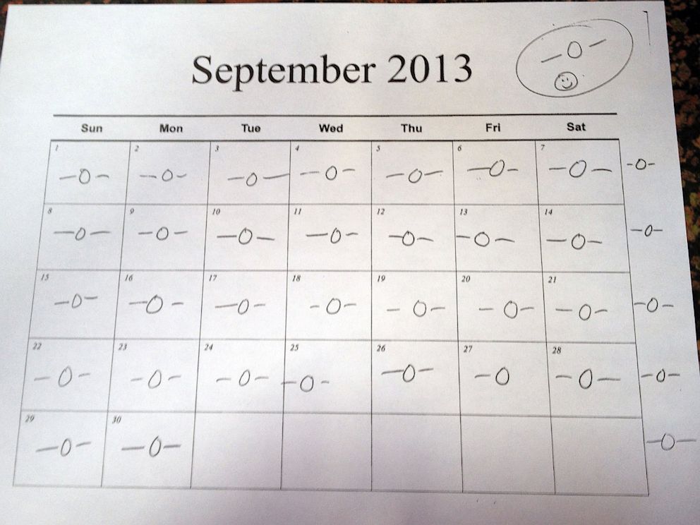 PHOTO: Since having MRI-guided laser surgery, Chris Murto has had all zeroes on his seizure chart.