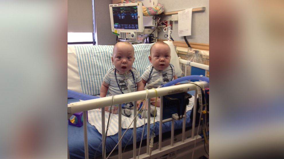 PHOTO: Formerly conjoined twins, Owen and Emmitt Ezell are released from Medical City Children's Hospital, April 15, 2014.