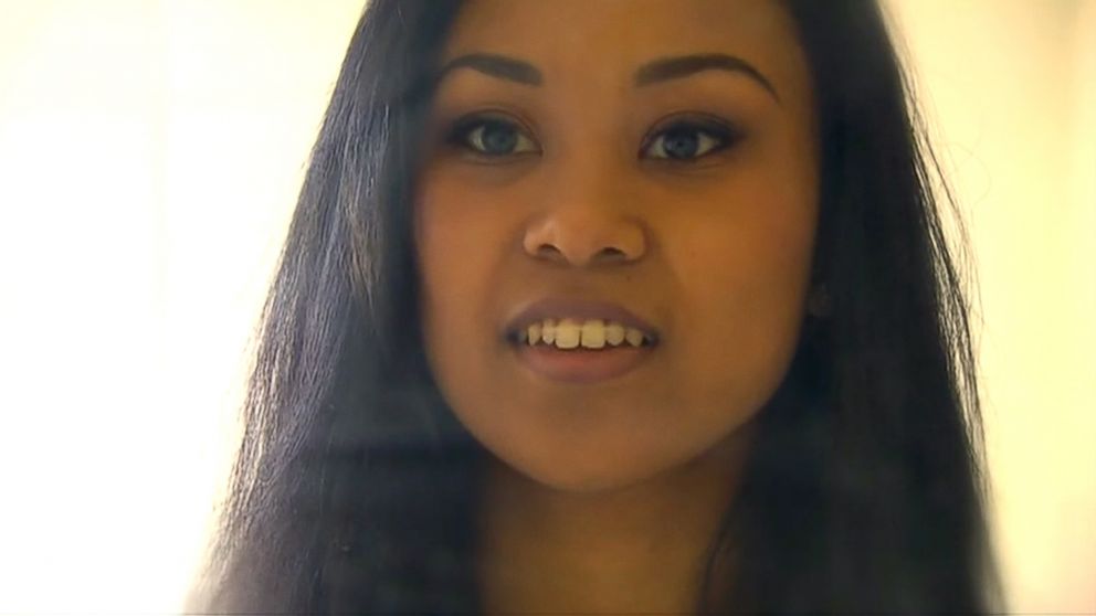 PHOTO: A Washington State woman claims she closed her tooth gap in 44 days using $5 worth of hair elastics.