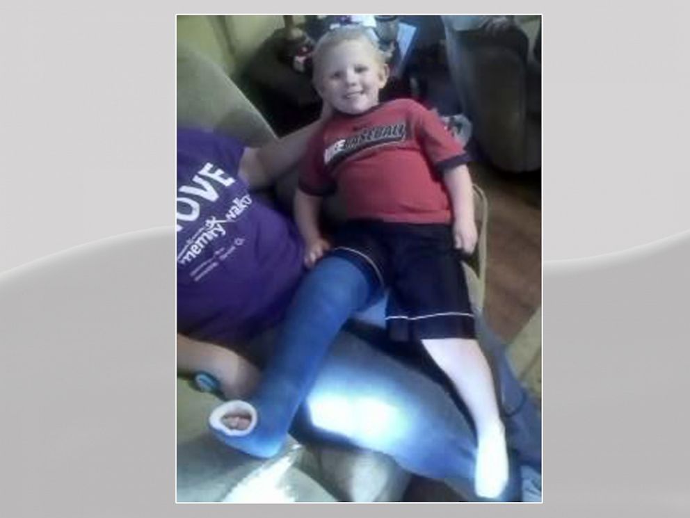 PHOTO: Isaac Brown didnt initially realize he broke his pelvis after a fall.