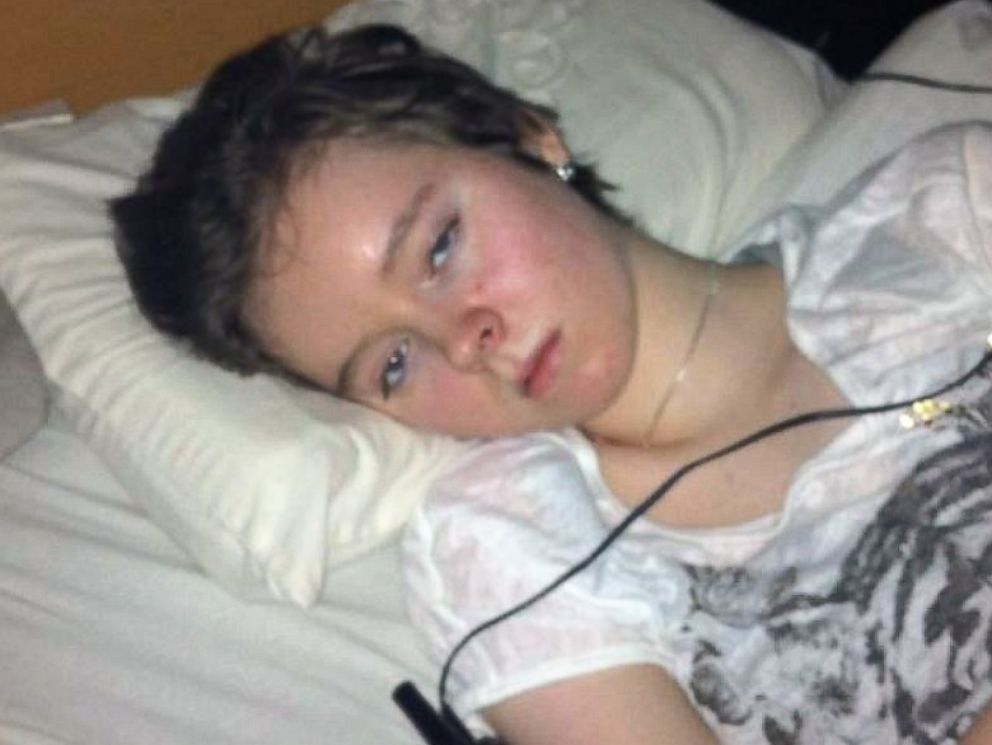 PHOTO: Jessica Taylor, 22, is confined to her bedroom with one of the most severe cases of myalgic encephalomyelitis or ME.