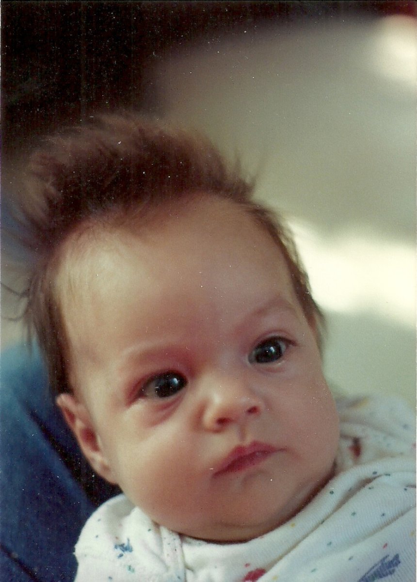 PHOTO: Laurie Lukianov was born with a life-threatening liver condition called biliary atresia. 