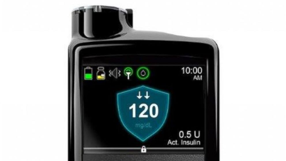 Medtronic plc announced it has received U.S. Food and Drug Administration (FDA) approval of its MiniMed 670G system, the first Hybrid Closed Loop insulin delivery system approved anywhere in the world.