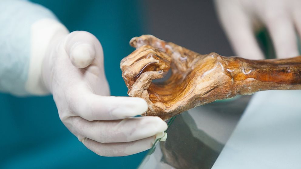 Secrets Of Iceman How A 5 300 Year Old Mummy Sheds Light On Evolution Migration Abc News