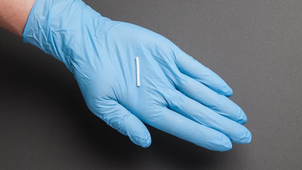 A newly FDA-approved implant, Probuphine, releases a low dose of medication to treat opioid addiction.