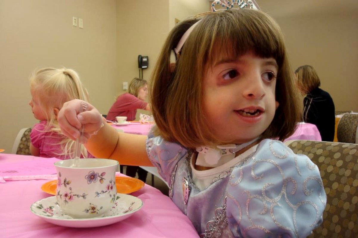 PHOTO: Hannah had a tracheostomy that affected her ability to speak and breathe easily.