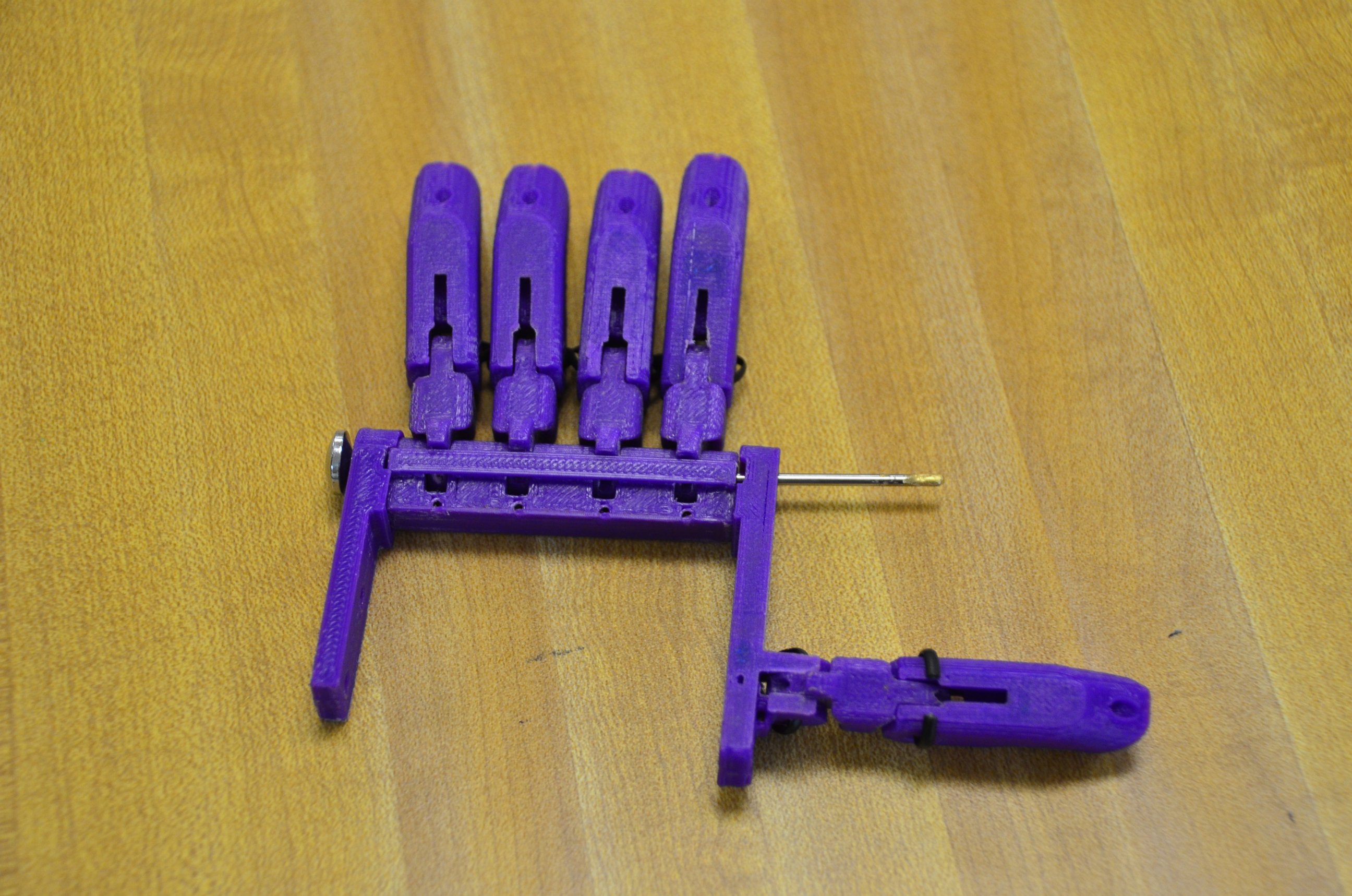 PHOTO: Kylie Wicker will receive her new 3D printed prosthetic hand on Friday.
