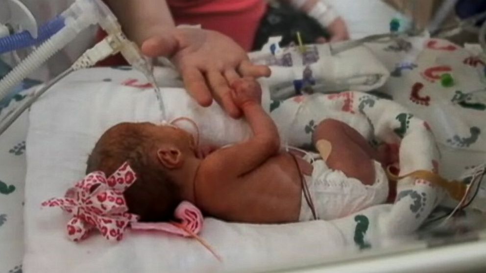 PHOTO: The babies weigh between 2 pounds, 7 ounces and 3 pounds, 6 ounces. 